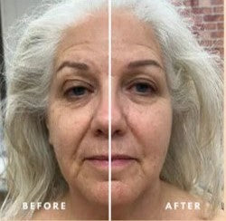 Cartelo™ Lymphatic Face Brush